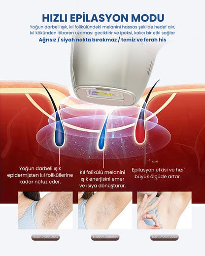 Myvane IPL Buz Başlıklı Lazer Epilasyon Cihazı - 999.999 Atış