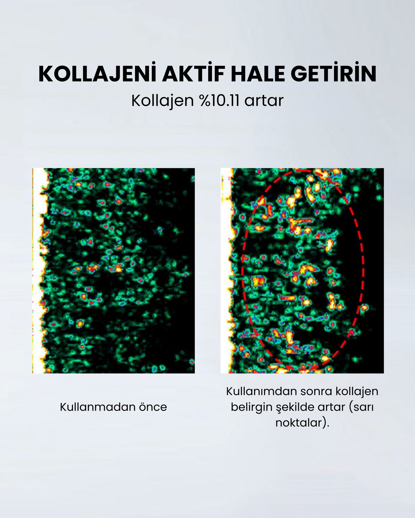 Myvane 6'sı 1 Arada Yüksek Frekanslı Güzellik Cihazı