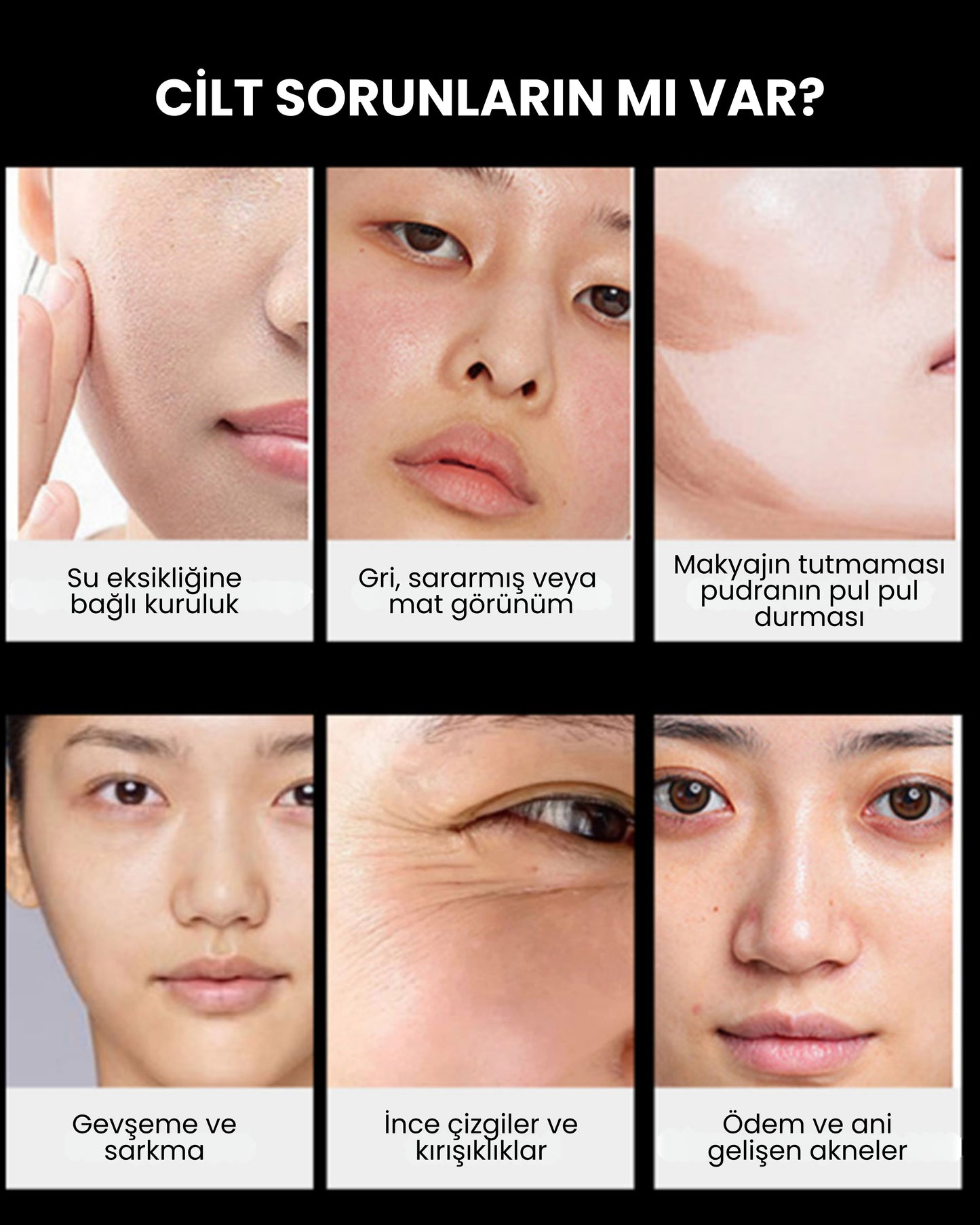 Myvane 6'sı 1 Arada Yüksek Frekanslı Güzellik Cihazı